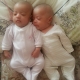 My twins story:- Asyraf Ramadhan & Aisyah Ramadhani melihat dunia buat pertama kali